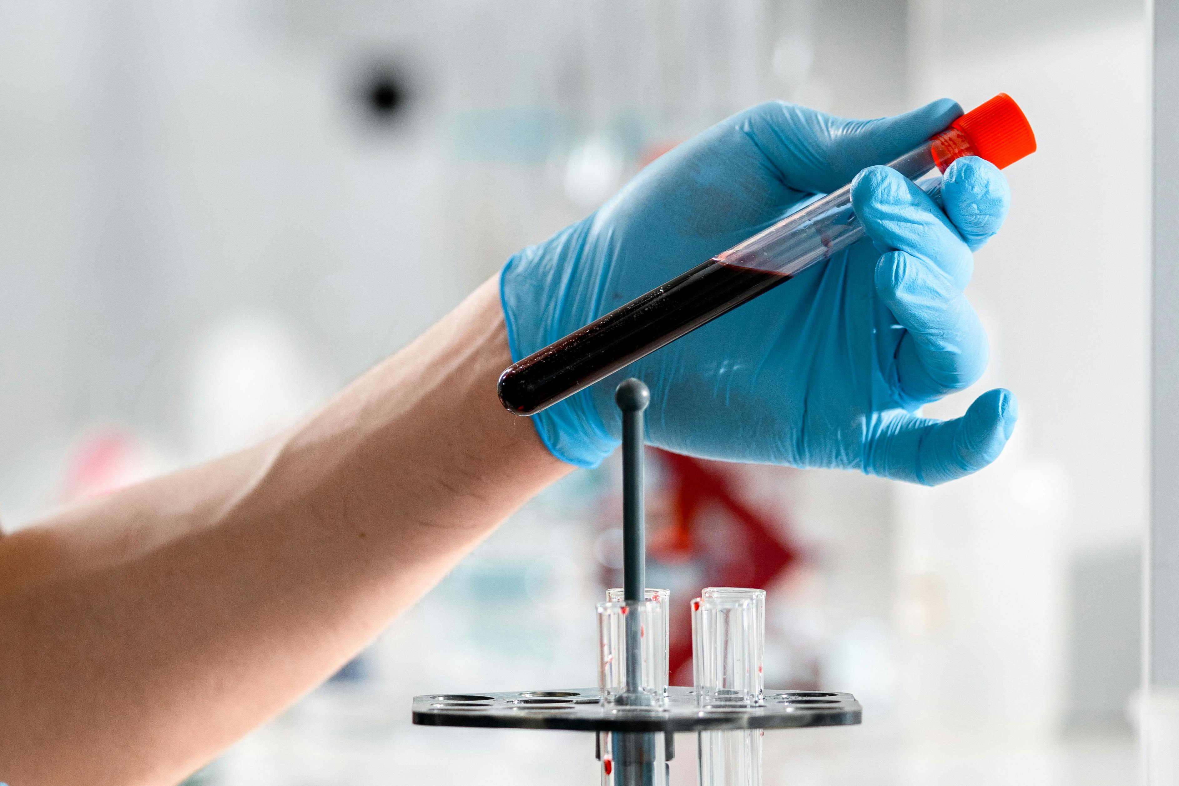 120925 Audiência MPAM e Semsa Exames laboratoriais Pexels 82d1e