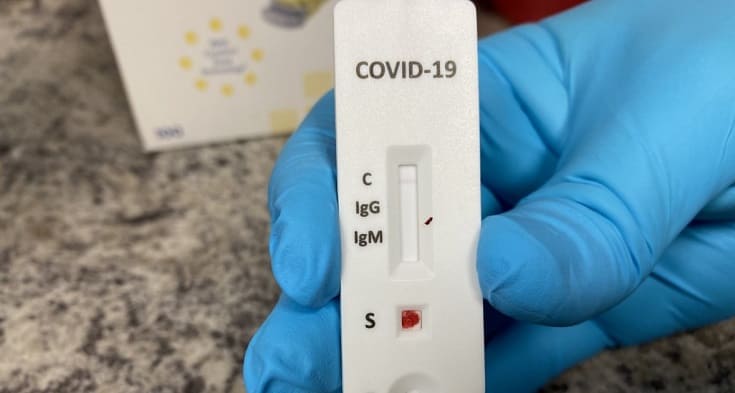 exame-teste-diagnostico-coronavirus 1d1ad